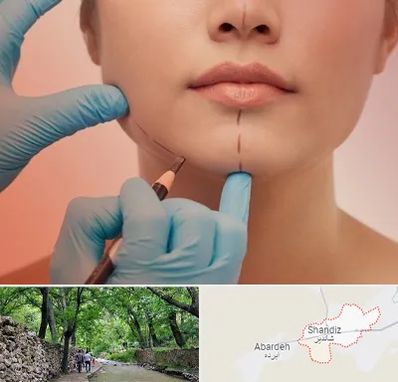 دکتر زیبایی خانم در شاندیز مشهد