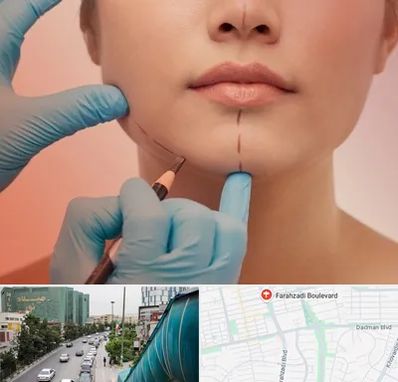 دکتر زیبایی خانم در بلوار فرحزادی
