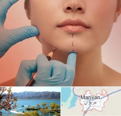 دکتر زیبایی خانم در مریوان