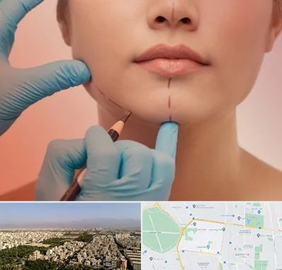 دکتر زیبایی خانم در نازی آباد 