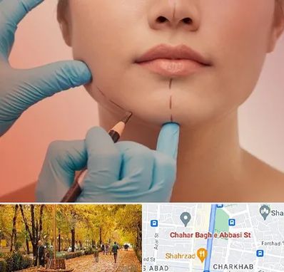 دکتر زیبایی خانم در چهارباغ اصفهان 