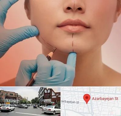 دکتر زیبایی خانم در خیابان آذربایجان