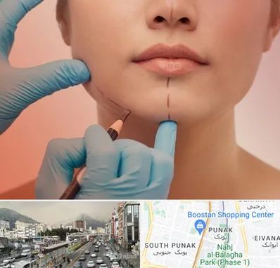 دکتر زیبایی خانم در پونک 