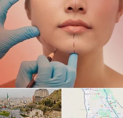 دکتر زیبایی خانم در فرهنگ شهر شیراز 