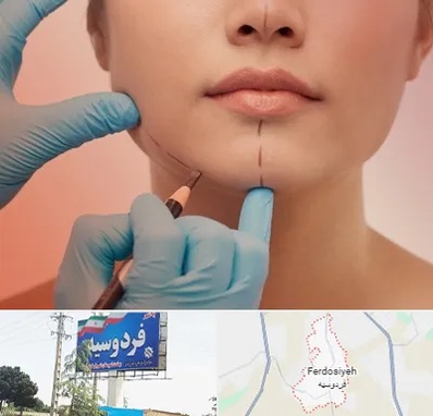 دکتر زیبایی خانم در فردوسیه شهریار