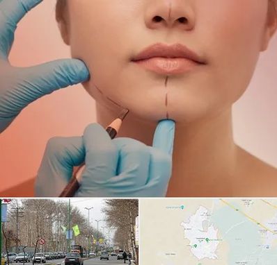 دکتر زیبایی خانم در نظرآباد کرج 