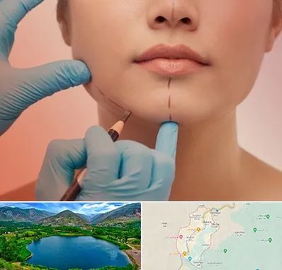 دکتر زیبایی خانم در رودبار