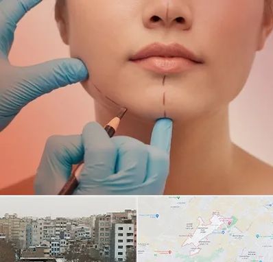 دکتر زیبایی خانم در محمد شهر کرج 