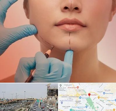 دکتر زیبایی خانم در بلوار توس مشهد 