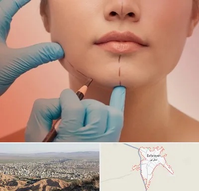 دکتر زیبایی خانم در اسفراین