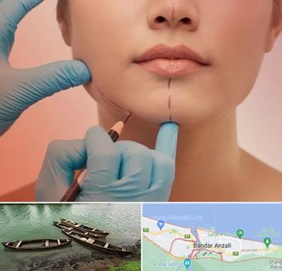 دکتر زیبایی خانم در بندر انزلی