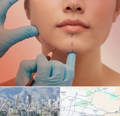 دکتر زیبایی خانم در شمال شرق تهران