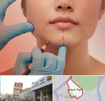 دکتر زیبایی خانم در شهرک شریعتی
