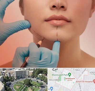 دکتر زیبایی خانم در جهانشهر کرج 