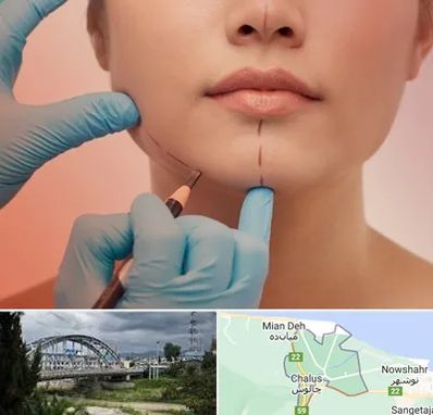 دکتر زیبایی خانم در چالوس