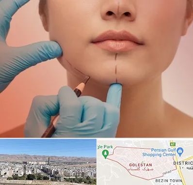 دکتر زیبایی خانم در شهرک گلستان شیراز 