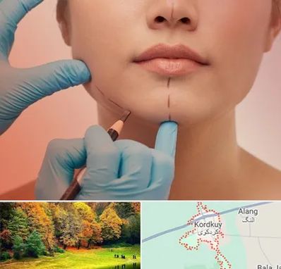 دکتر زیبایی خانم در کردکوی