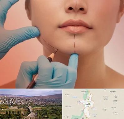 دکتر زیبایی خانم در بوکان