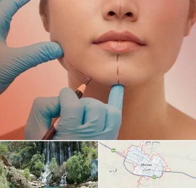دکتر زیبایی خانم در شیروان