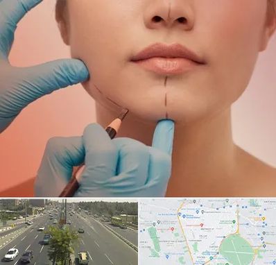 دکتر زیبایی خانم در منطقه 17 تهران 