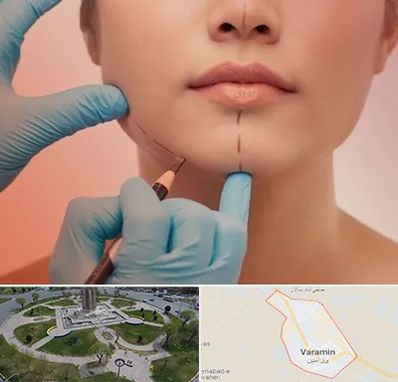 دکتر زیبایی خانم در ورامین