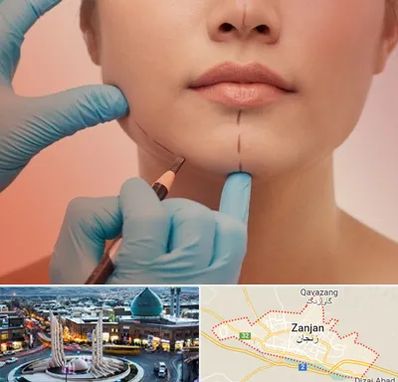 دکتر زیبایی خانم در زنجان