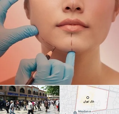 دکتر زیبایی خانم در بازار تهران