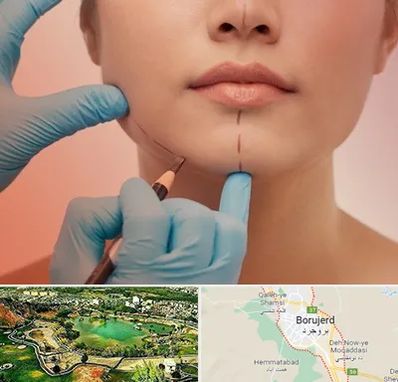 دکتر زیبایی خانم در بروجرد