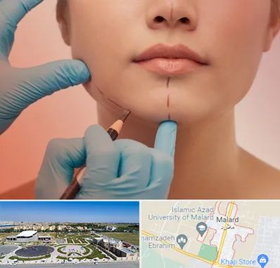 دکتر زیبایی خانم در ملارد