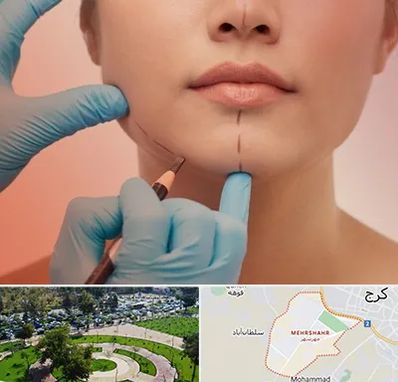 دکتر زیبایی خانم در مهرشهر کرج 