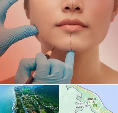 دکتر زیبایی خانم در رامسر