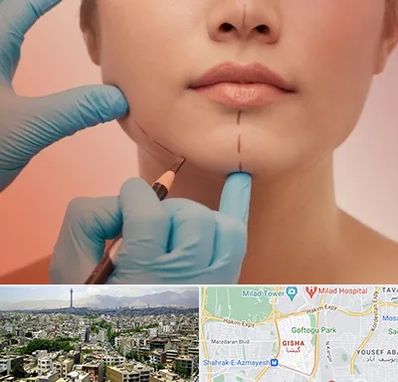 دکتر زیبایی خانم در گیشا 