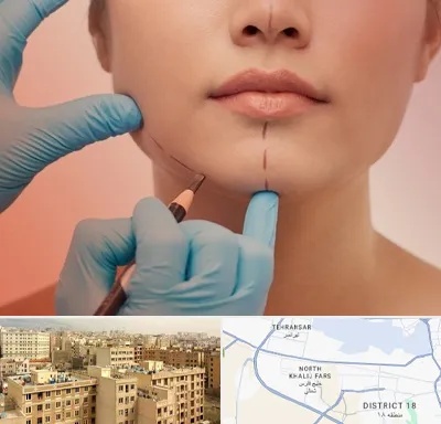 دکتر زیبایی خانم در جنوب غرب تهران