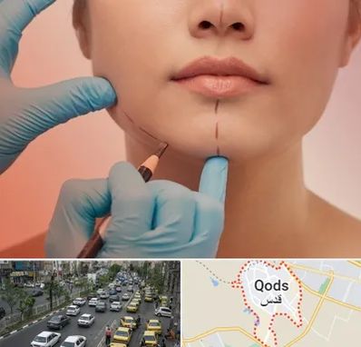 دکتر زیبایی خانم در شهر قدس