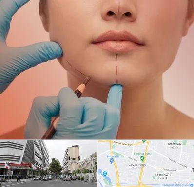 دکتر زیبایی خانم در بلوار فردوس 