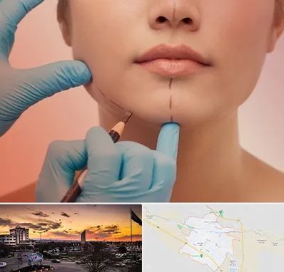 دکتر زیبایی خانم در قوچان