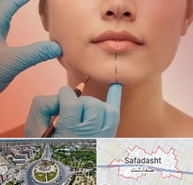 دکتر زیبایی خانم در صفادشت