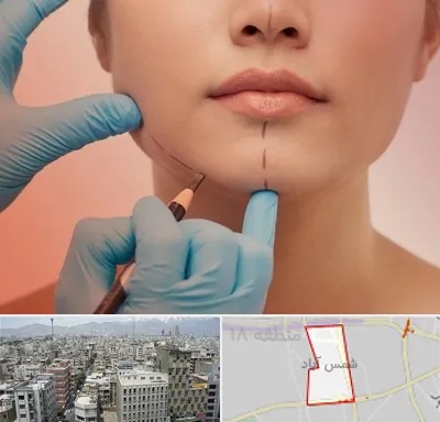 دکتر زیبایی خانم در شمس آباد تهران