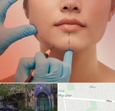 دکتر زیبایی خانم در بریانک