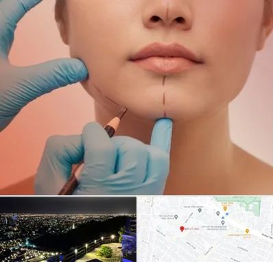 دکتر زیبایی خانم در هفت تیر مشهد 