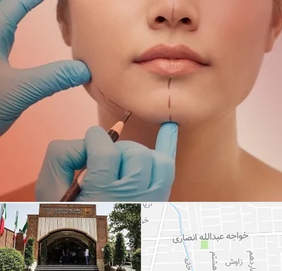 دکتر زیبایی خانم در خواجه عبدالله