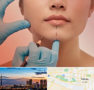 دکتر زیبایی خانم در غرب تهران 