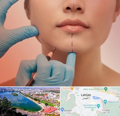 دکتر زیبایی خانم در لاهیجان