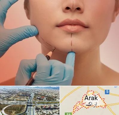 دکتر زیبایی خانم در اراک