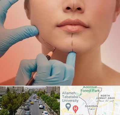 دکتر زیبایی خانم در شهران 