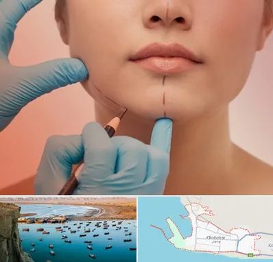 دکتر زیبایی خانم در چابهار