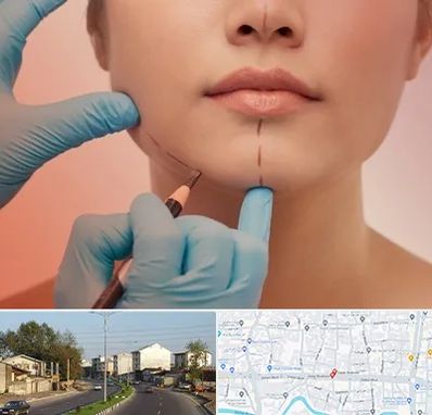 دکتر زیبایی خانم در ضیابری رشت 