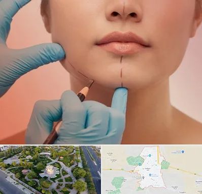 دکتر زیبایی خانم در کاشمر