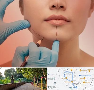 دکتر زیبایی خانم در فلکه گاز رشت 