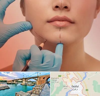 دکتر زیبایی خانم در دزفول